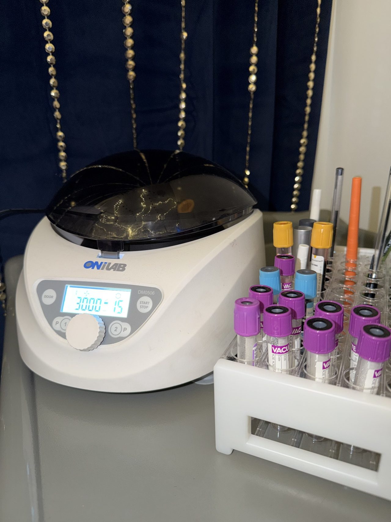 The lab centrifuge with sample tubes